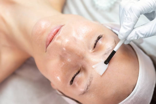 Skincare professional applying chemical peel