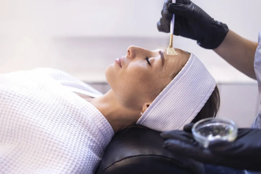 Preview image for how-chemical-peels-improve-skin