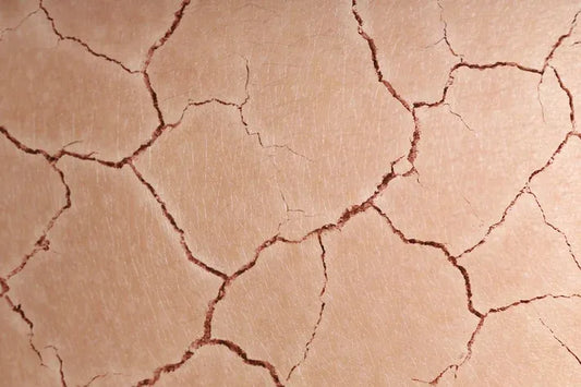close up view of impaired skin barrier