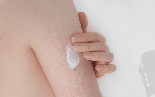 Preview image for keratosis_pilaris_and_how_to_treat_it