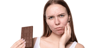 Preview image for misconceptions-of-acne