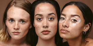 Preview image for normalize_real_skin_aug_2021