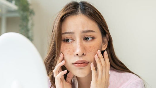 Preview image for purging-breaking-out-is-your-new-skin-care-working