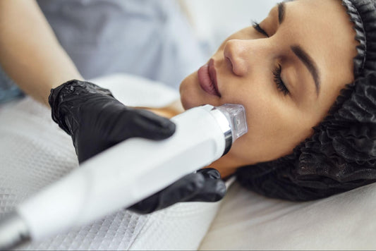 woman receiving rf microneedling treatment